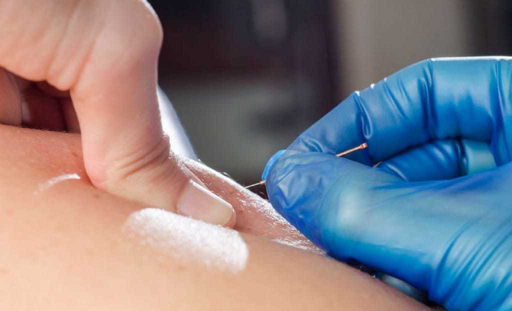 muscle recovery process